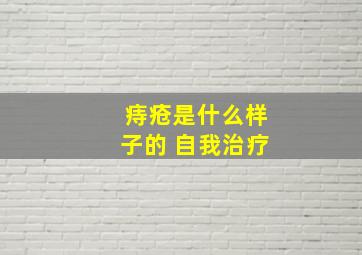 痔疮是什么样子的 自我治疗